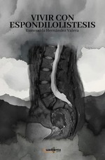 Vivir con espondilolistesis